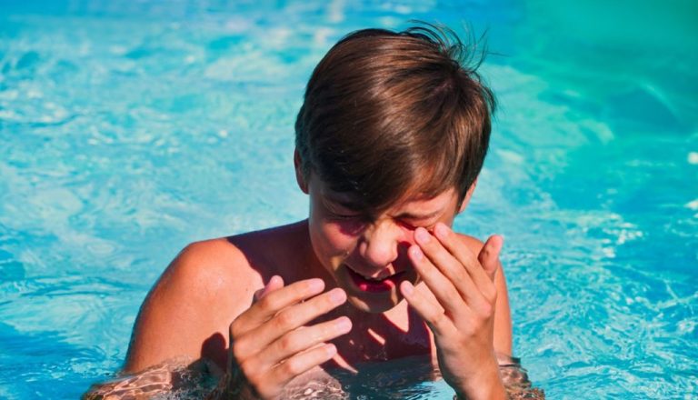 Klorin në pishinë nuk duhet ta nënvlerësoni – rreziku për sytë është real